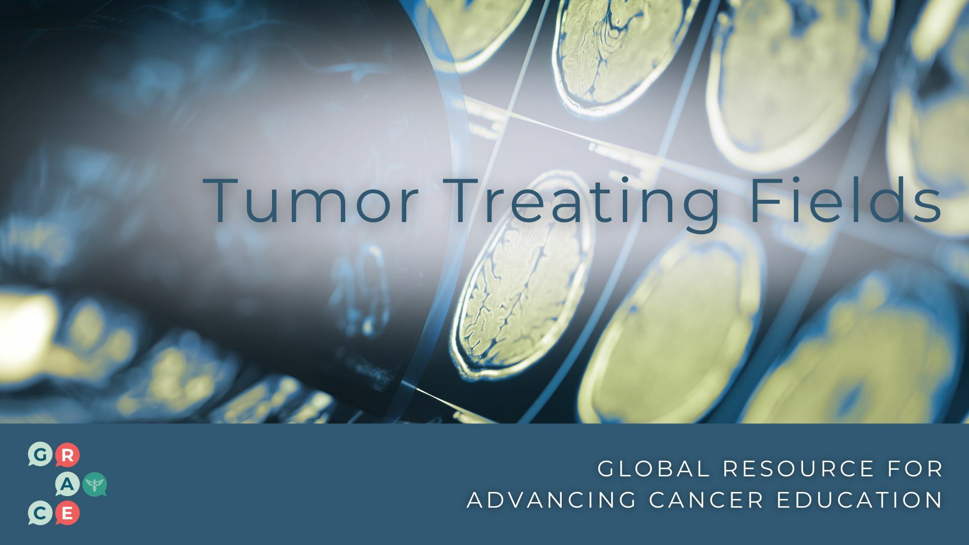 Tumor Treating Fields 2023 