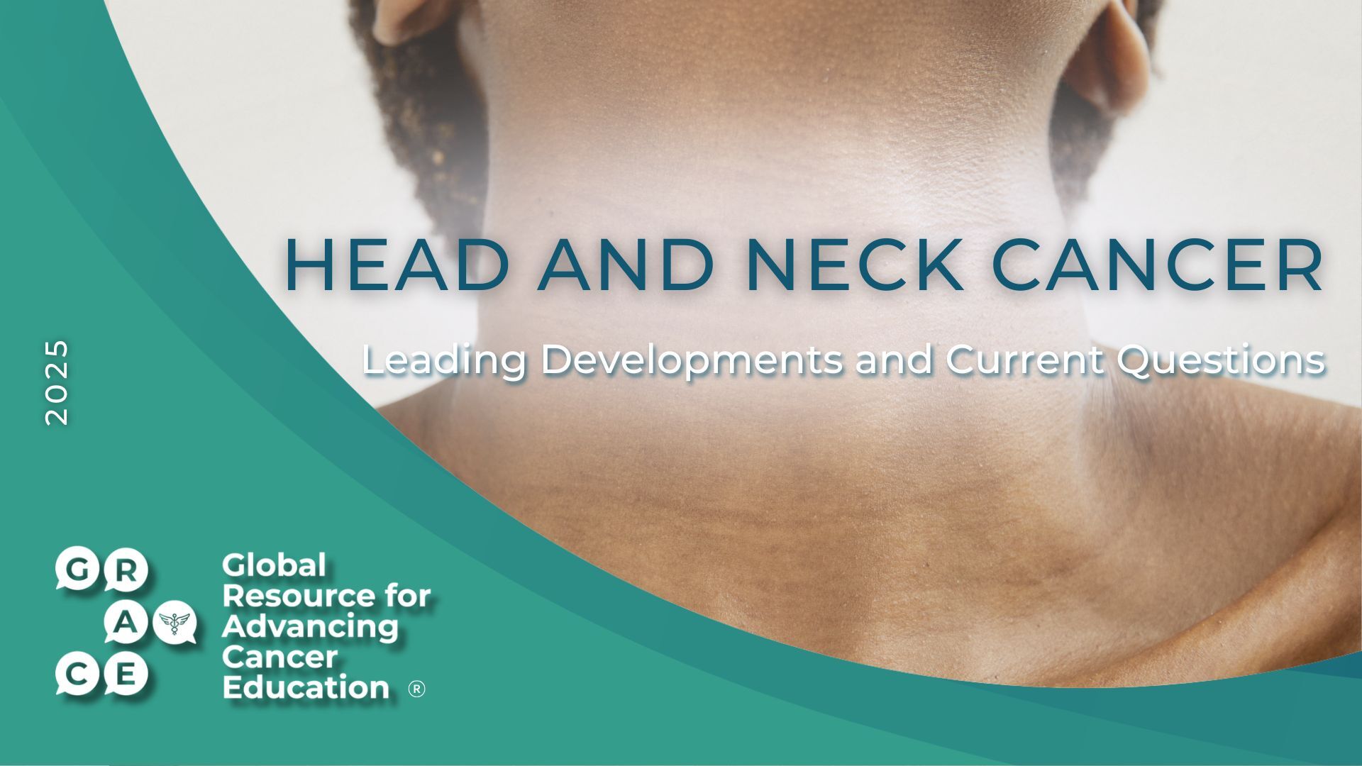 Head and Neck cancer 2025